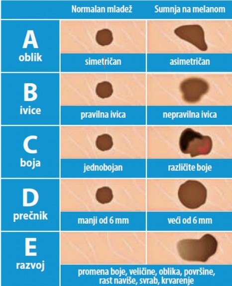 tabela mladeži