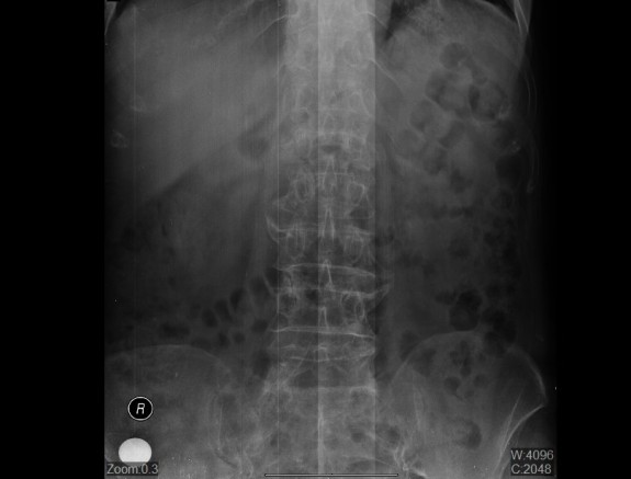 Fotografija-op. zahvata.