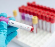 hiv