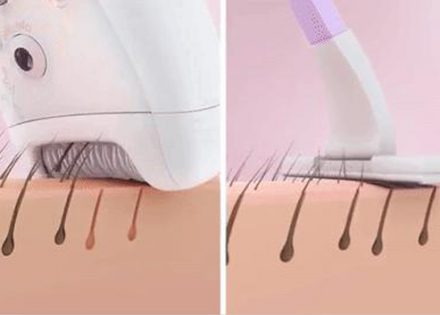 epilator