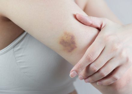 modrice