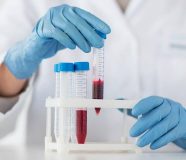 hemoglobin
