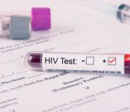 hiv test