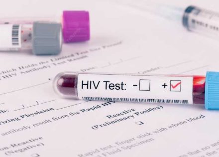 hiv test